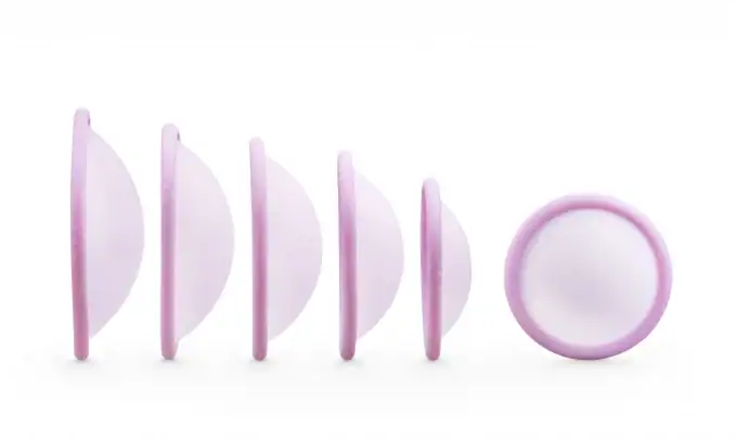 Singa pessarium als anticonceptie