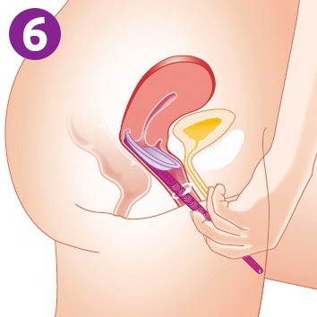 inserter_6_1280x1280